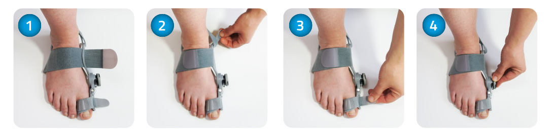 Νάρθηκας για Κότσι Corrector PRO | AVPneumAid Corrector PRO Hallux Valgus Ημέρας & Νύχτας.