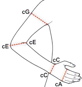 ss207pi | AVPneumAid